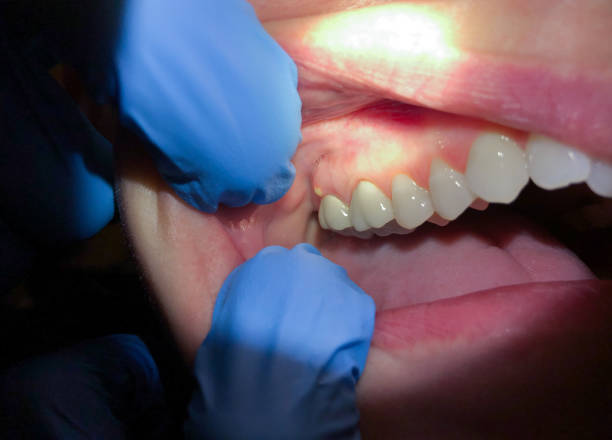 Best Holiday Emergency Dentist in Woodlawn, VA